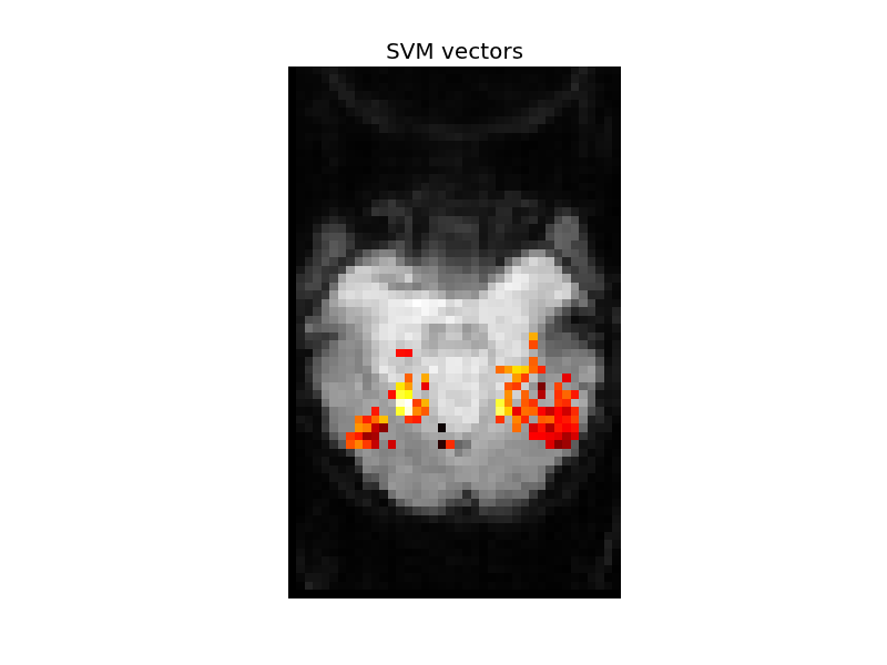 _images/plot_haxby_simple_1.png