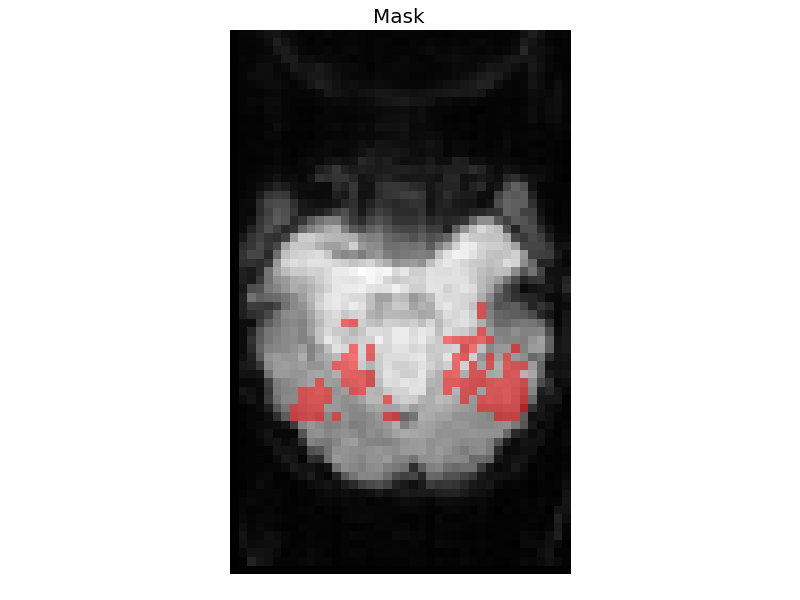 _images/plot_haxby_simple_2.png