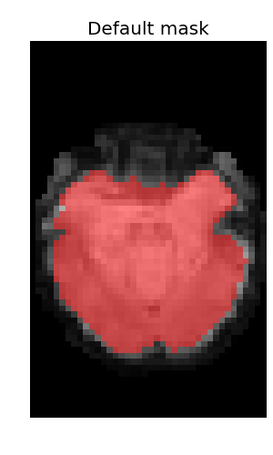 _images/plot_nifti_advanced_1.png
