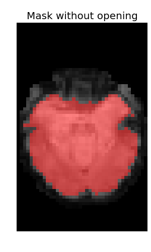 _images/plot_nifti_advanced_2.png